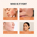Thumbnail for Dr.Sakhiya Acne & Pimple Morning Cream - Distacart