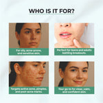 Thumbnail for Dr.Sakhiya Acne & Pimple Moisturizer - Distacart