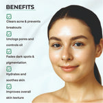 Thumbnail for Dr.Sakhiya Acne & Pimple Moisturizer - Distacart
