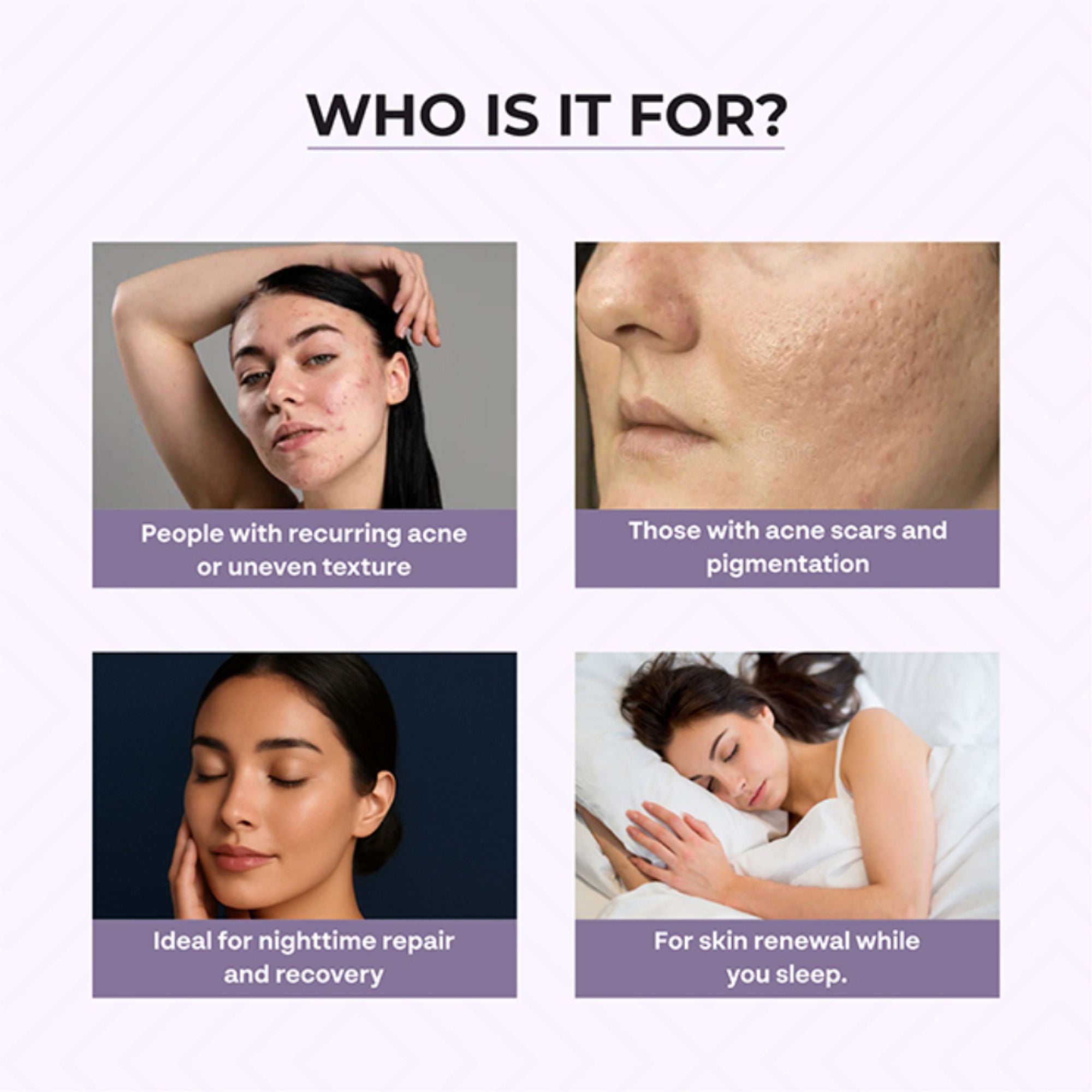 Dr.Sakhiya Acne & Pimple Night Cream - Distacart