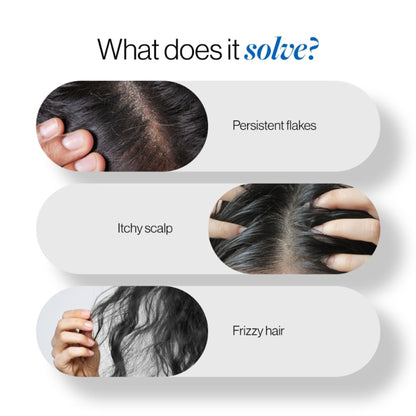 BeBodywise ZPTO Anti Dandruff Shampoo - Reduces Dandruff, Flaking & Deeply Hydrates Scalp - Dista