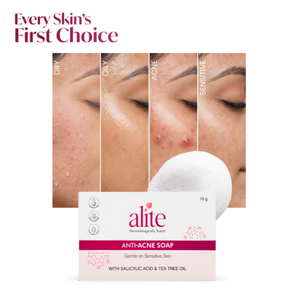 Alite Anti-Acne Soap - Distacart