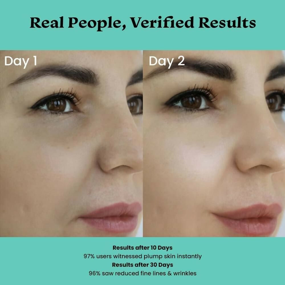 Foxtale Over Night Glow Mask For Glowing Skin, 4% Glycolic Acid & 3% Lactic Acid, Reduces Blackheads and Whiteheads - Distacart