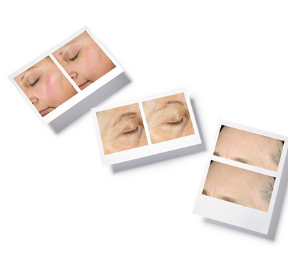 Murad Hydration Intense Recovery Cream - Distacart