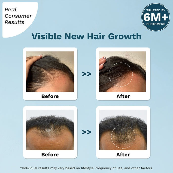 Pilgrim Redensyl & Anagain Advanced Hair Growth Serum - Distacart