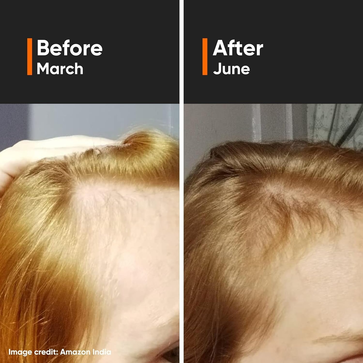 Minimalist Hair Growth Actives 18% - Distacart