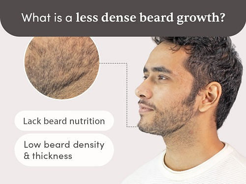 Man Matters Beardmax Growth Serum - Distacart