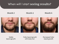 Thumbnail for Man Matters Beardmax Growth Serum - Distacart