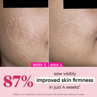 Dot & Key Pomegranate Miracle Vitamin E Revitalizing Moisturizer - Distacart
