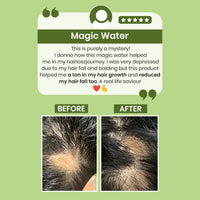 Thumbnail for Alps Goodness Rosemary Water for Hair Regrowth - Distacart