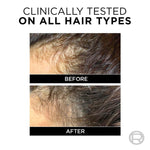 Thumbnail for L'Oreal Paris Fall Resist 3X Anti-Hairfall Shampoo
