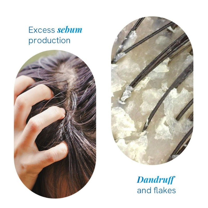 BeBodywise 1% Ketoconazole Dandruff Shampoo For Smooth & Frizz Free Hair