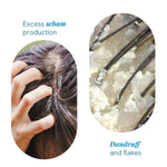 Thumbnail for BeBodywise 1% Ketoconazole Dandruff Shampoo For Smooth & Frizz Free Hair