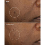 Thumbnail for Clinique Even Better Clinical Brightening Moisturizer