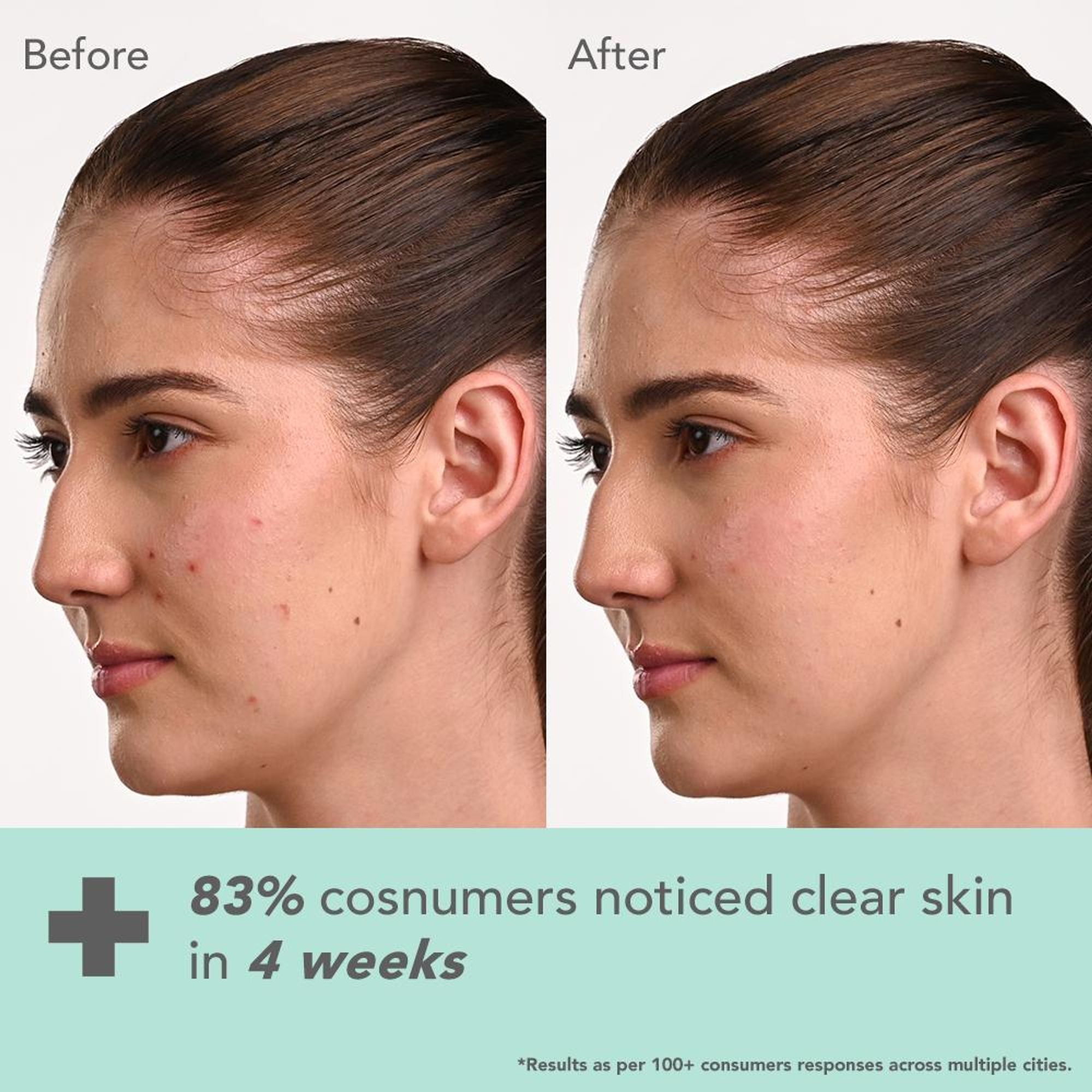 Lotus DermaBotanics Kojic Acid + Multi Berry Ampoule Crème, pH5.5, For Sensitive Skin additional image 4