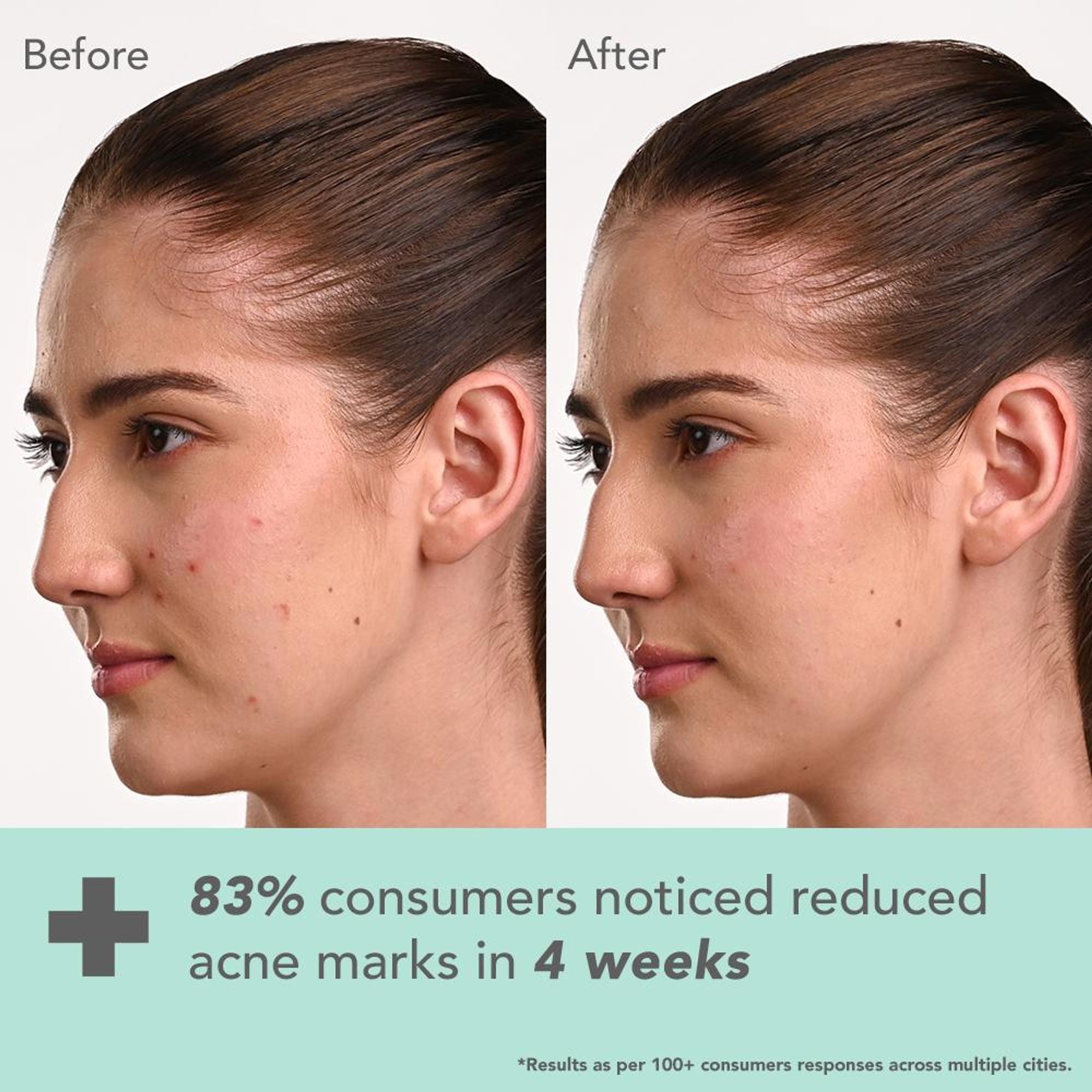 Lotus Herbals Derma Botanics Hi-Dose Serum Kojic Acid + Multi Berry, PH5.5 For Sensitive Skin additional image 4