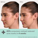 Thumbnail for Lotus Herbals Derma Botanics Hi-Dose Serum Kojic Acid + Multi Berry, PH5.5 For Sensitive Skin additional image 4