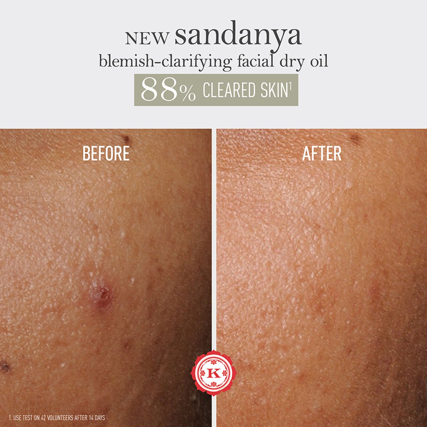 Kama Ayurveda Sandanya Blemish Clarifying Dry Oil - Dista
