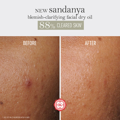 Kama Ayurveda Sandanya Blemish Clarifying Dry Oil - Dista