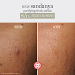 Thumbnail for Kama Ayurveda Sandanya Purifying Fresh Serum