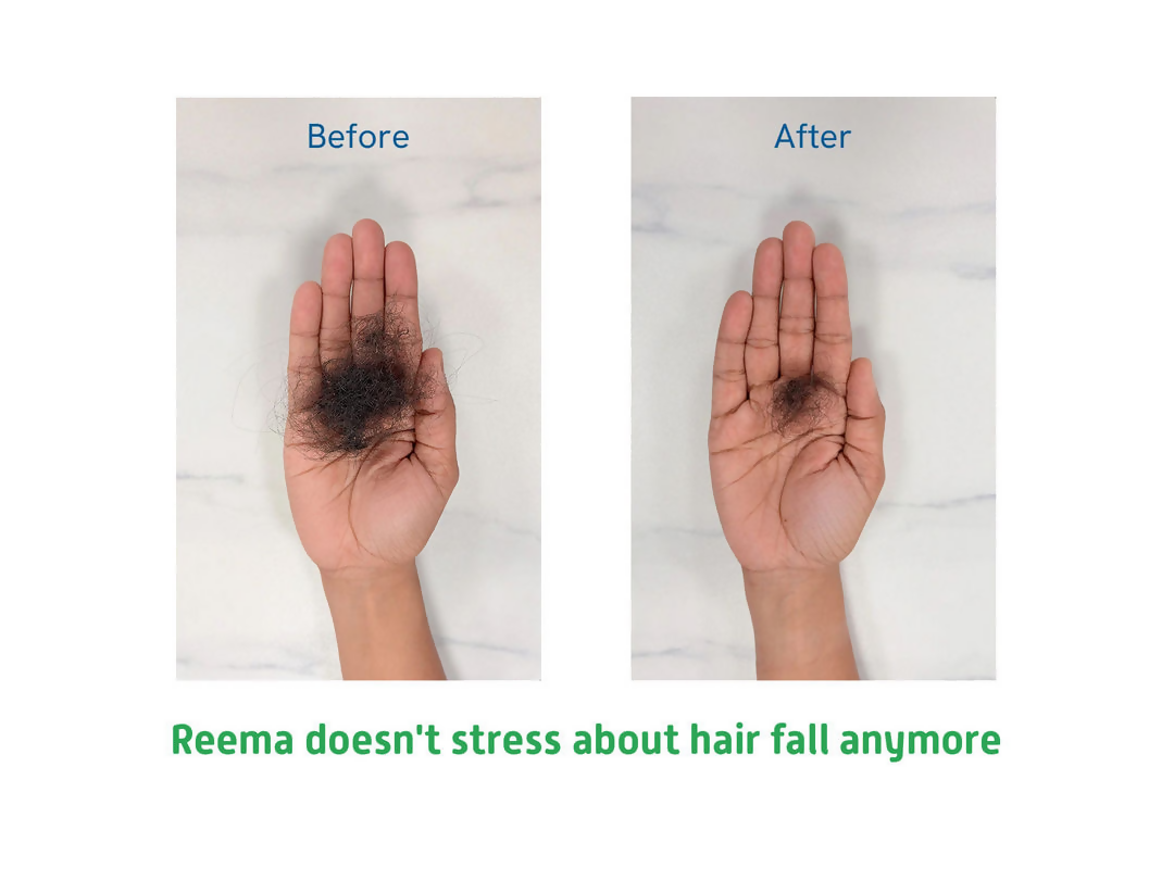 Little Joys Biotin Hair Gummies Strawberry Flavor For Moms