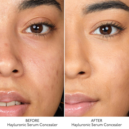 By Terry Hyaluronic Serum Concealer - 4. Rosy Nude - Distacart