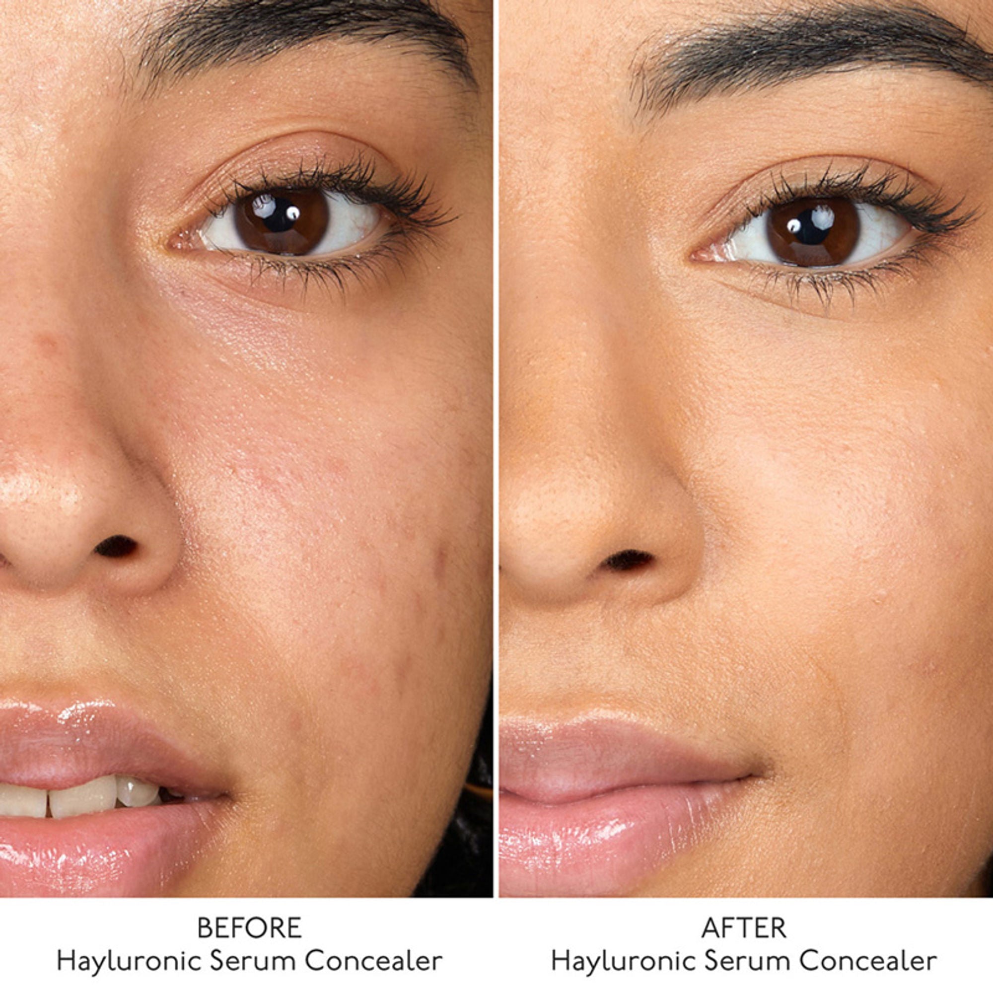 By Terry Hyaluronic Serum Concealer - 5. Cream Beige - Distacart
