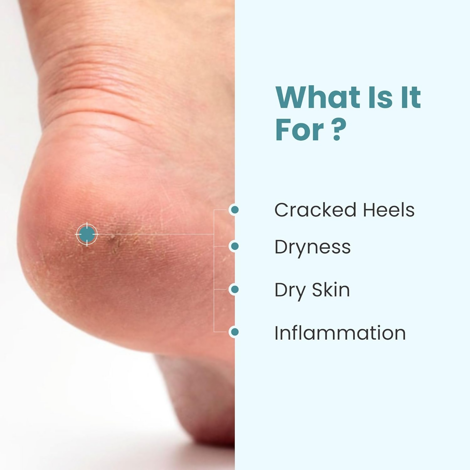 Uniqaya Foot Care Cream Repairs Cracked Heel - Distacart