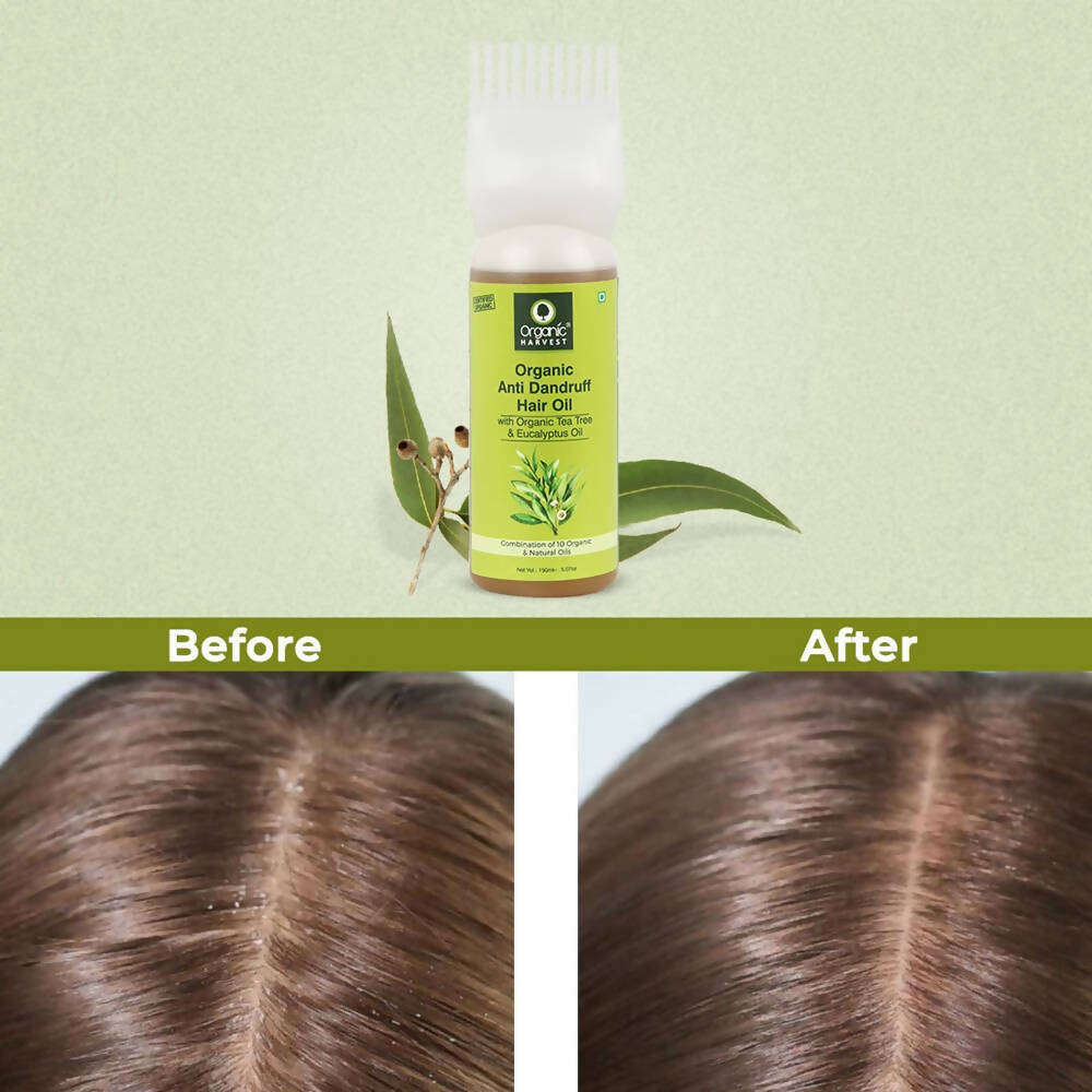 Organic Harvest Organic Anti Dandruff Hair Oil - Distacart