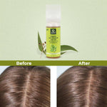 Thumbnail for Organic Harvest Organic Anti Dandruff Hair Oil - Distacart