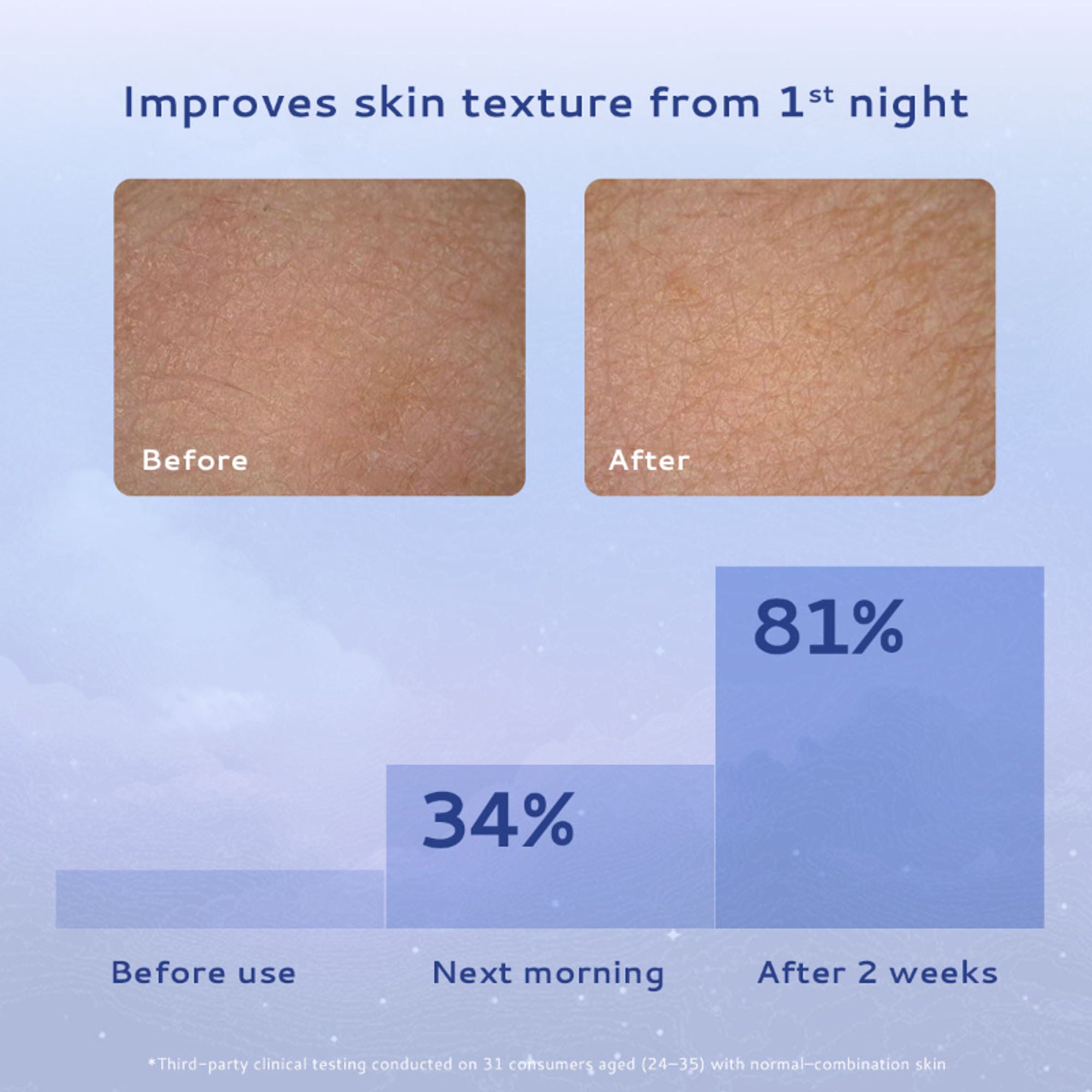 Lumineve Combination Skin Moisturizer with Niacinamide - Lightweight Gel For Oil-Free Hydration - Distacart