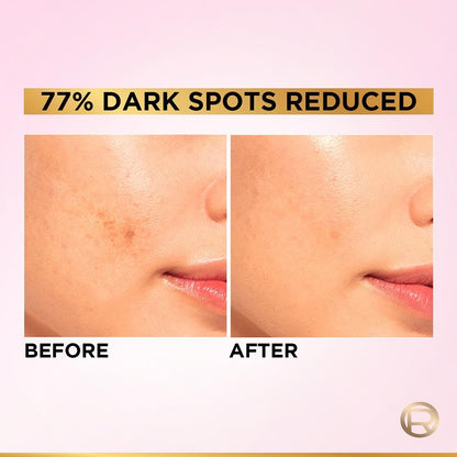 L'Oreal Paris Glycolic Bright 8% [Melasyl + Niacinamide] Face Serum For Brightening Dark Spots - Distacart