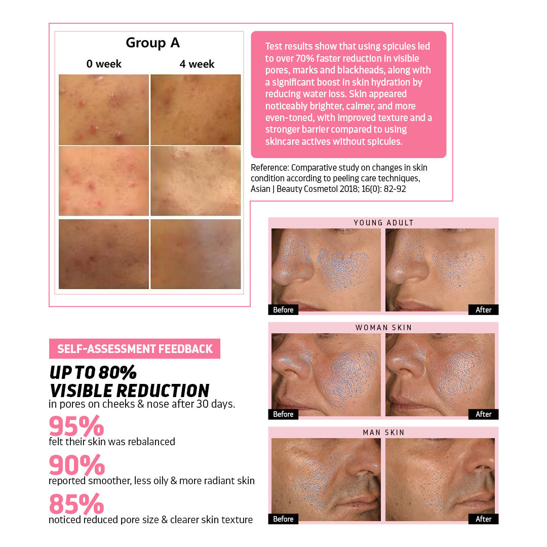 Indulgeo Essentials Cica Reedle Essence With PDRN