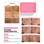 Thumbnail for Indulgeo Essentials Cica Reedle Essence With PDRN