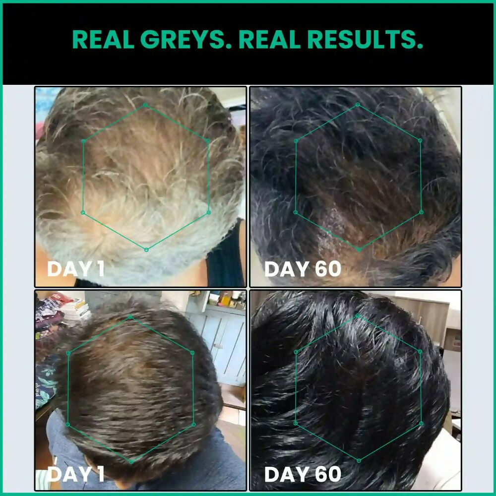 ThriveCo Anti-Greying Hair Prime Serum - Distacart