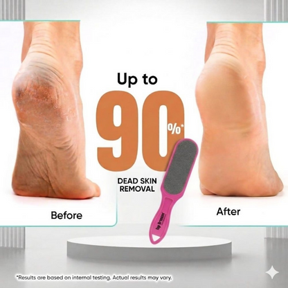 Bronson Professional Double Sided Emery Foot File Callus, Dead Skin Remover - Dista