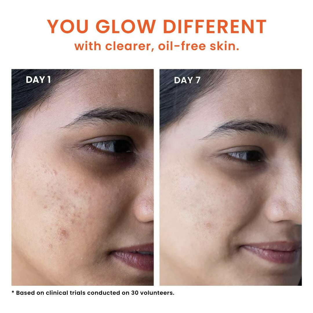 Foxtale Oil & Acne Control Face Wash - Dista