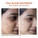 Thumbnail for Foxtale Oil & Acne Control Face Wash