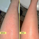 Thumbnail for PLIX The Plant Fix Pineapple 5% Lactic Acid Body Wash Exfoliates Dry, Rough & Strawberry Skin