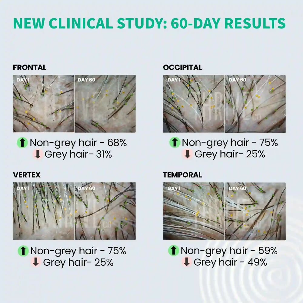 ThriveCo Anti-Greying Hair Prime Serum - Distacart