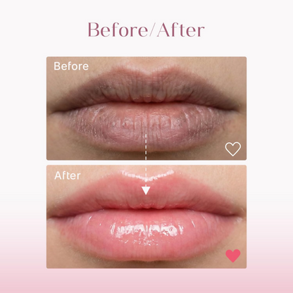 Seoulskin Brightening Lip Balm with SPF 50 PA++ - Distacart