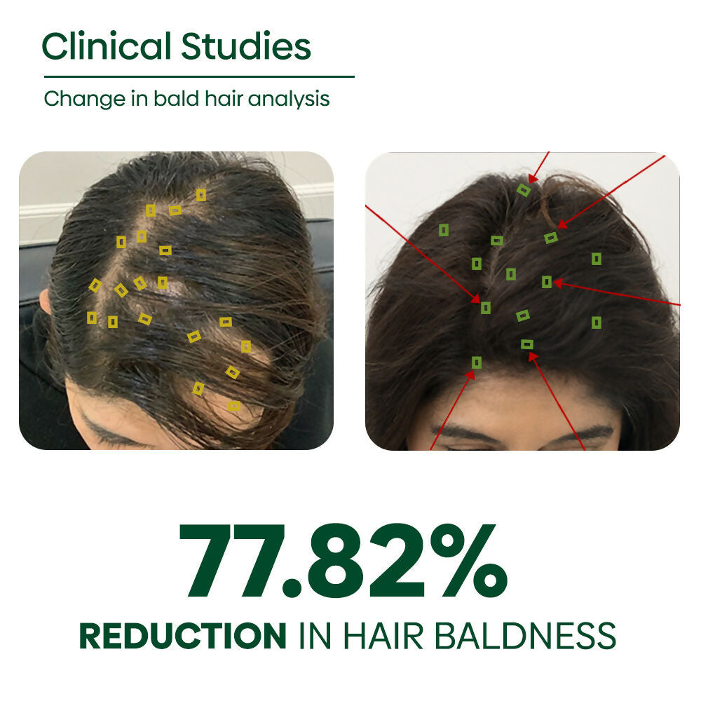 Copy of ADIVASI HAIR OIL PERCENTAGE