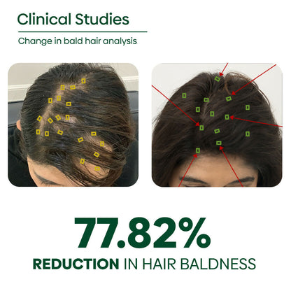 Copy of ADIVASI HAIR OIL PERCENTAGE