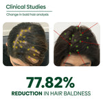 Thumbnail for Copy of ADIVASI HAIR OIL PERCENTAGE