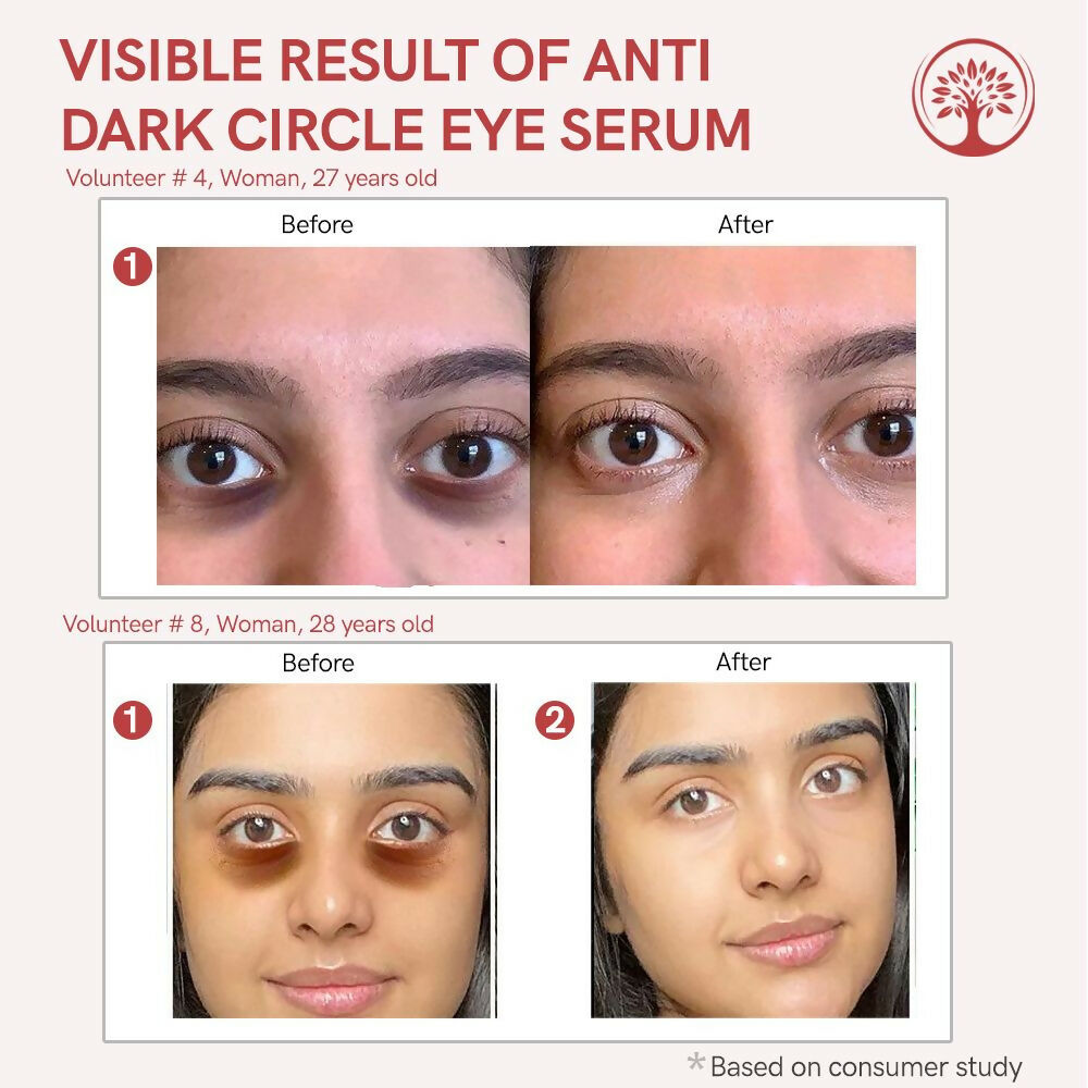 Ivory Natural Dark Circle Eye Serum For Dark Eye Circles, Under-Eye Patches, Swollen Eyes - Distacart