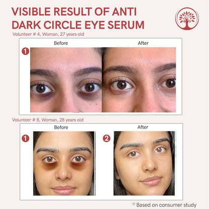 Ivory Natural Dark Circle Eye Serum For Dark Eye Circles, Under-Eye Patches, Swollen Eyes - Distacart