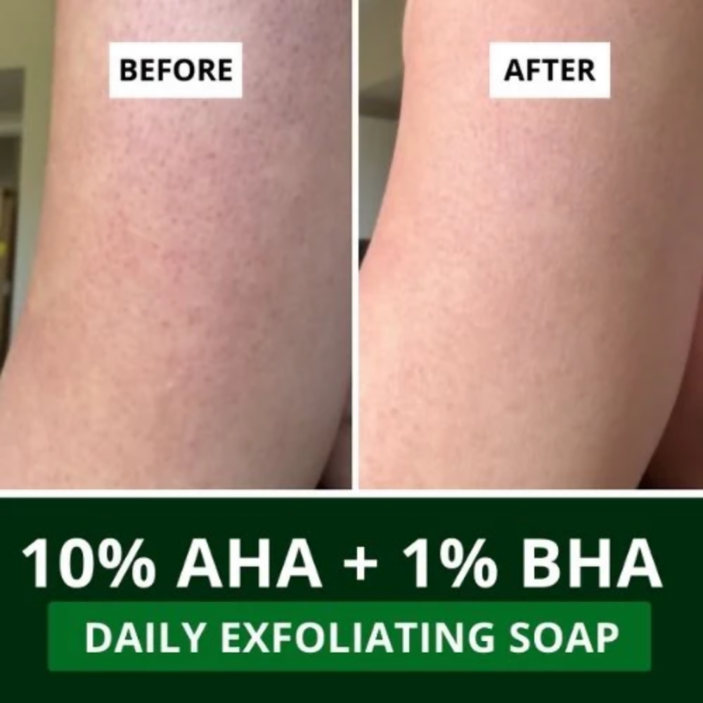 Bake 10% AHA + 1% BHA Scrub Treatment Soap