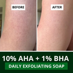 Thumbnail for Bake 10% AHA + 1% BHA Scrub Treatment Soap