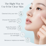 Thumbnail for Seoulskin Salicylic Acid Pimple Patches - Distacart