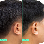 Thumbnail for PLIX The Plant Fix Rosemary Advanced Hair Kit - Distacart